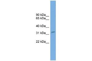WB Suggested Anti-C2orf25 Antibody Titration: 0.