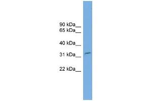 WB Suggested Anti-C2orf25 Antibody Titration: 0. (MMADHC anticorps  (N-Term))