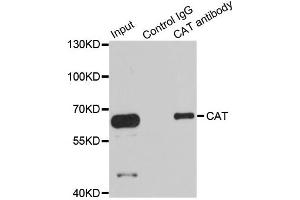 Immunoprecipitation analysis of 100ug extracts of HepG2 cells using 3ug CAT antibody. (Catalase anticorps)