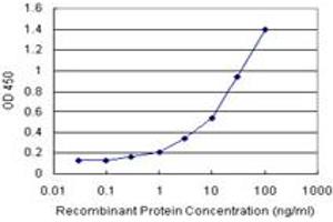 Sandwich ELISA detection sensitivity ranging from 0. (TARBP2 (Humain) Matched Antibody Pair)