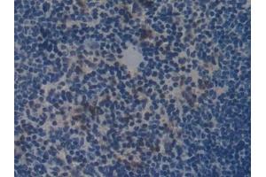 Detection of COL1a2 in Mouse Spleen Tissue using Polyclonal Antibody to Collagen Type I Alpha 2 (COL1a2)