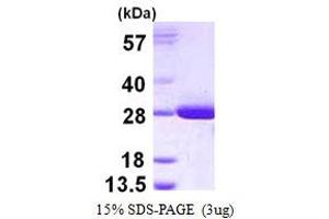 Image no. 1 for Glutathione S-Transferase theta 2 (GSTT2) protein (His tag) (ABIN1098234) (GSTT2 Protein (His tag))