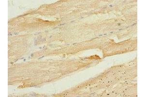 Immunohistochemistry of paraffin-embedded human skeletal muscle tissue using ABIN7146597 at dilution of 1:100 (CALU anticorps  (AA 20-315))