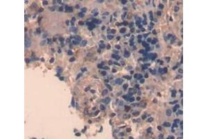 IHC-P analysis of Rat Tissue, with DAB staining. (CD5L anticorps  (AA 11-346))