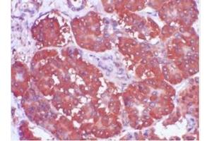Immunohistochemistry (IHC) image for anti-Trefoil Factor 1 (TFF1) (AA 57-84), (C-Term) antibody (ABIN781662) (TFF1 anticorps  (C-Term))