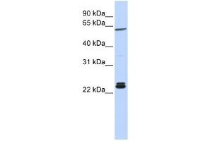 H1F0 antibody used at 1 ug/ml to detect target protein. (Histone H1 anticorps  (N-Term))