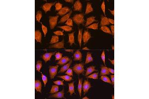 Immunofluorescence analysis of L929 cells using NCSTN Rabbit pAb (ABIN7268905) at dilution of 1:100.