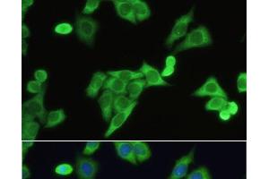 Immunofluorescence analysis of HeLa cells using SLC2A9 Polyclonal Antibody at dilution of 1:100. (SLC2A9 anticorps)