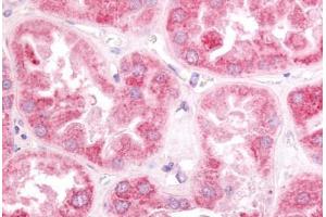 Human Kidney (formalin-fixed, paraffin-embedded) stained with ESRRG antibody ABIN213503 at 10 ug/ml followed by biotinylated goat anti-rabbit IgG secondary antibody ABIN481713, alkaline phosphatase-streptavidin and chromogen.