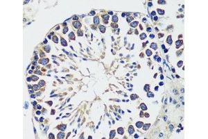 Immunohistochemistry of paraffin-embedded Mouse testis using CCDC124 Polyclonal Antibody at dilution of 1:100 (40x lens). (CCDC124 anticorps)