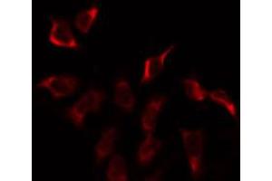 ABIN6274915 staining Hela by IF/ICC. (GUSBP2 anticorps)