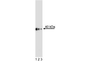 Western Blot analysis of CDX-2 in human colorectal adenocarcinoma.