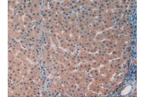 IHC-P analysis of Human Liver Tissue, with DAB staining.