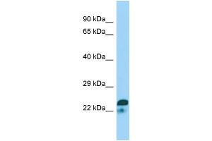 WB Suggested Anti-SPIN2A Antibody Titration: 1. (SPIN2A anticorps  (N-Term))