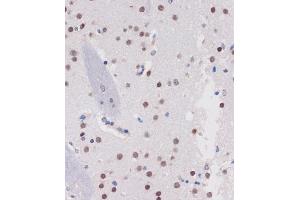 Immunohistochemistry of paraffin-embedded Mouse brain using B Rabbit pAb (ABIN7265702) at dilution of 1:100 (40x lens). (ARID1B anticorps  (AA 400-650))
