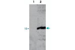 Detecting RPS19 protein in HepG2 cell homogenate. (RPS19 anticorps)