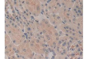 Detection of MAP4 in Rat Kidney Tissue using Polyclonal Antibody to Microtubule Associated Protein 4 (MAP4)
