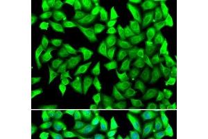 Immunofluorescence analysis of U2OS cells using VTI1B Polyclonal Antibody (VTI1B anticorps)