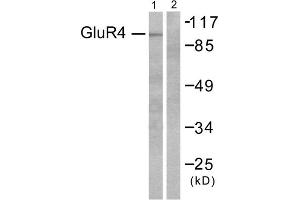 Western blot analysis of extracts from 293 cells, untreated or treated with Forskolin (40nM, 30mins), using GluR4 antibody (ABIN5976411). (Metabotropic Glutamate Receptor 4 anticorps  (C-Term))