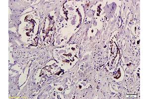 Formalin-fixed and paraffin embedded mouse stomach tissue labeled with Anti-phospho-eIF4EBP1(Thr37/46) Polyclonal Antibody, Unconjugated (ABIN682978) 1:200 followed by conjugation to the secondary antibody and DAB staining