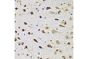Immunohistochemistry of paraffin-embedded rat brain using ADRBK1 Antibody.