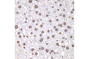 Immunohistochemistry of paraffin-embedded mouse liver using TOP1 antibody (ABIN6290286) at dilution of 1:100 (40x lens). (Topoisomerase I anticorps)