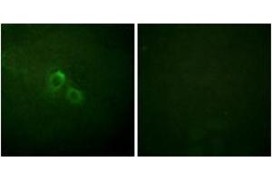 Immunofluorescence analysis of HuvEc cells, using Kv1. (KCNA3 anticorps  (AA 101-150))