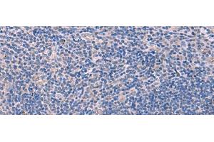 Immunohistochemistry of paraffin-embedded Human tonsil tissue using SCCPDH Polyclonal Antibody at dilution of 1:85(x200) (SCCPDH anticorps)