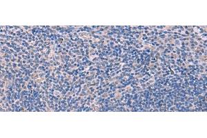 Immunohistochemistry of paraffin-embedded Human tonsil tissue using SCCPDH Polyclonal Antibody at dilution of 1:85(x200)
