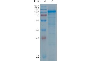 Human PTGFRN Protein, His Tag on SDS-PAGE under reducing condition.