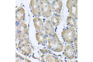 Immunohistochemistry of paraffin-embedded human gastric using BAG5 antibody at dilution of 1:100 (x40 lens). (BAG5 anticorps)