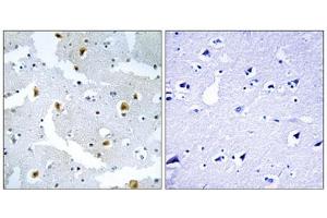 Immunohistochemistry analysis of paraffin-embedded human brain tissue using FMN2 antibody.