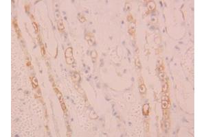 IHC-P analysis of Human Kidney Tissue, with DAB staining. (ALOX15 anticorps  (AA 170-312))