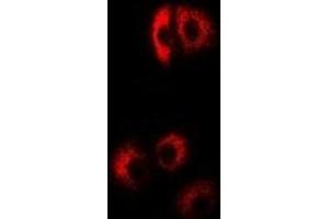 Immunofluorescent analysis of EIF4B staining in Hela cells. (EIF4B anticorps)
