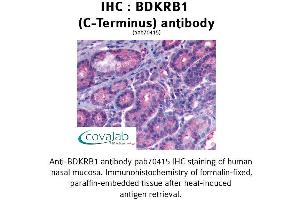 Image no. 1 for anti-Bradykinin Receptor B1 (BDKRB1) (C-Term) antibody (ABIN2852366) (BDKRB1 anticorps  (C-Term))