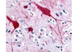 Immunohistochemistry (IHC) image for anti-Solute Carrier Family 5 (Sodium/glucose Cotransporter), Member 9 (SLC5A9) (C-Term) antibody (ABIN2469312)