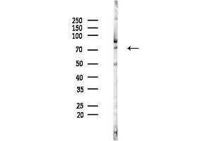 Western blot analysis of lysates from HUVEC cells(starvation 24h treatment), using TRIM69 Antibody at 1/1000 dilution.
