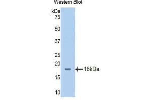 Western blot analysis of the recombinant protein. (SLC3A2 anticorps  (AA 213-349))