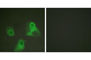 P-peptide - +Immunofluorescence analysis of HeLa cells, using ADD1 (phospho-Ser726) antibody (#A0002).
