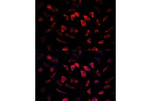 Immunofluorescence analysis of L929 cells using IGFBP4 antibody (ABIN6130488, ABIN6142255, ABIN6142256 and ABIN6219173) at dilution of 1:100. (IGFBP4 anticorps  (AA 22-258))