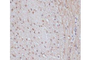 Immunohistochemistry of paraffin-embedded Rat brain using SNW1 Polyclonal Antibody at dilution of 1:100 (40x lens).