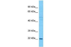 Western Blotting (WB) image for anti-TLC Domain Containing 1 (TLCD1) (C-Term) antibody (ABIN2791939) (TLCD1 anticorps  (C-Term))