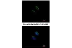 ICC/IF Image Immunofluorescence analysis of methanol-fixed HeLa, using GnT-III, antibody at 1:200 dilution. (MGAT3 anticorps)