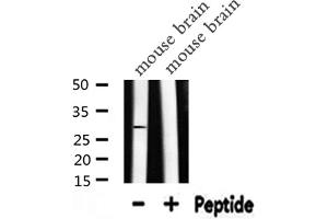 Western blot analysis of CA2 expression in Mouse brain lysate