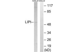 Western blot analysis of extracts from COLO cells, using LIPI antibody. (Lipase I anticorps  (Internal Region))
