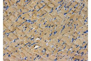 ABIN7093976 and ABIN7098020 at 1/100 staining Rat brain tissue by IHC-P.