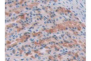 DAB staining on IHC-P; Samples: Rat Stomach Tissue
