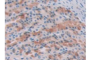 DAB staining on IHC-P; Samples: Rat Stomach Tissue (CCL17 anticorps  (AA 27-93))