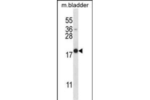 MYOG Antibody (N-term) (ABIN657743 and ABIN2846727) western blot analysis in mouse bladder tissue lysates (35 μg/lane). (Myogenin anticorps  (N-Term))