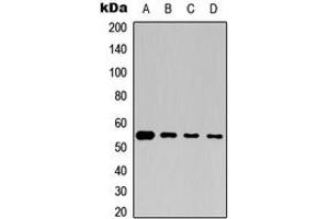 Western blot analysis of Beta-tubulin expression in Jurkat (A), K562 (B), mouse brain (C), rat brain (D) whole cell lysates. (TUBB anticorps  (C-Term))